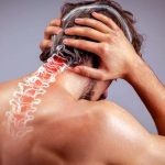 دیسک گردن چیست | بهترین روشهای درمان دیسک گردن