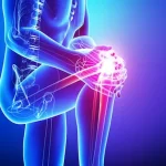 علت درد کشکک زانو چیست؟ - بررسی 10 علت اصلی