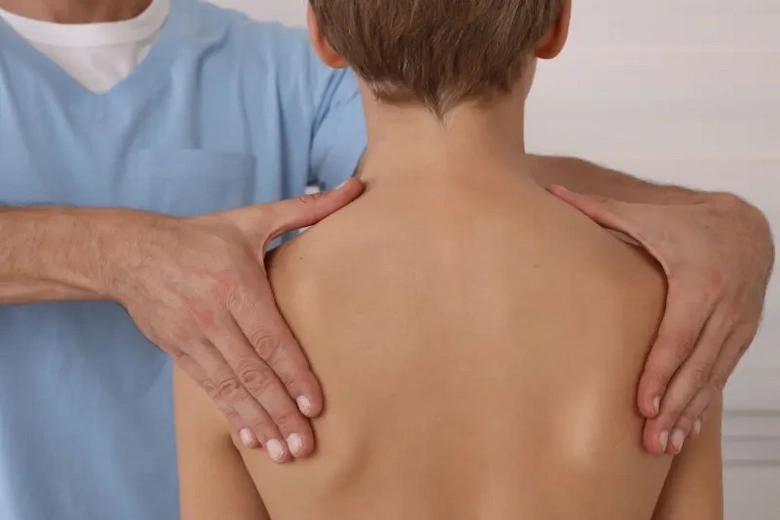 تصویری از درمان قوز کمر در نوجوانان