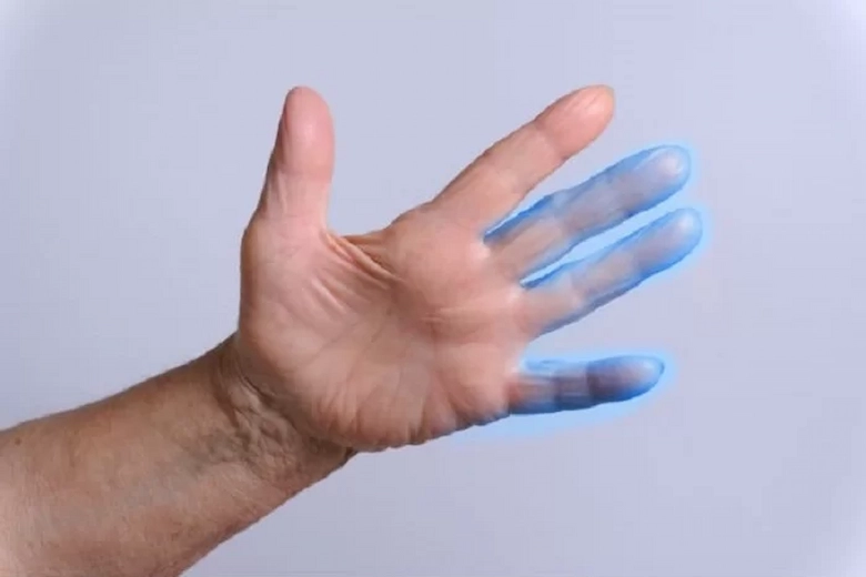 تصویری از گزگز کردن دست و پا