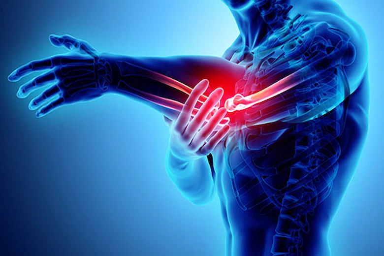 علائم آرتروز آرنج دست