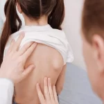 درمان قوز کمر در کودکان - 6 روش درمان و بهترین راهکارهای تشخیص و جلوگیری