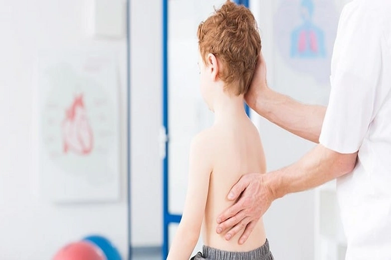 تصویری از درمان قوز کمر کودکان