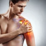 بورسیت شانه چیست؟ - بررسی 0 تا 100 علل و علائم